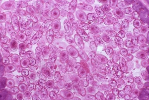 C4-2B，前列-腺癌细胞 产品图片