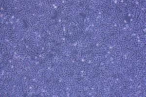 SK-OV-3细胞 [SKOV-3] 卵巢-癌细胞系 产品图片