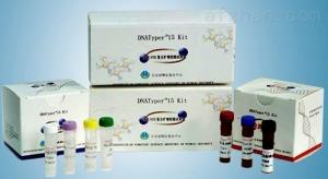 霍乱弧菌139型PCR检测试剂盒图片