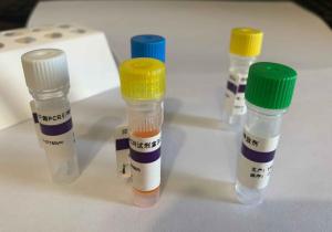 单纯疱疹病毒(HSV)检测试剂盒(荧光-PCR法） 产品图片