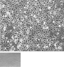 小鼠肺微内皮细胞 产品图片