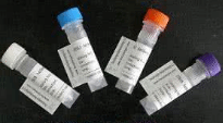 β淀粉样肽1-40 C端/Aβ1-40 C端抗体 产品图片