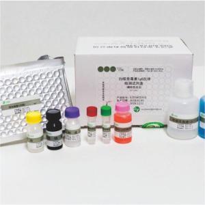 白喉类毒素IgG抗体检测试剂盒