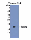 干扰素γ(IFNg)多克隆抗体（人）